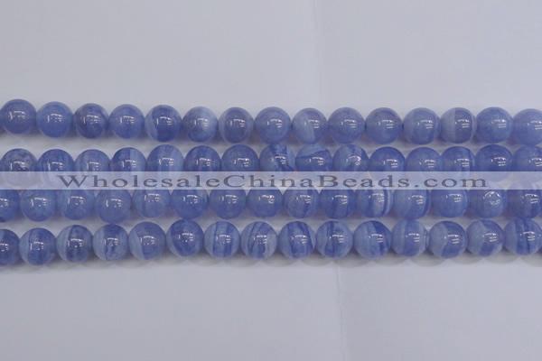 CAG5973 15.5 inches 10mm round blue lace agate beads wholesale